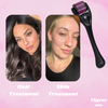 Thryve Derma Roller™️